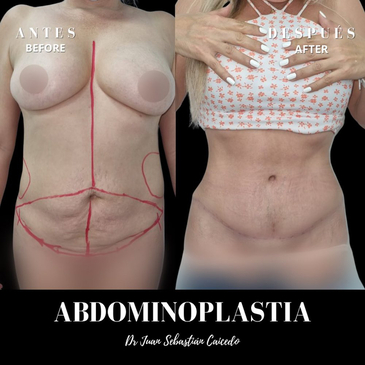 Slider image (4) Dr. Juan Sebastian Caicedo